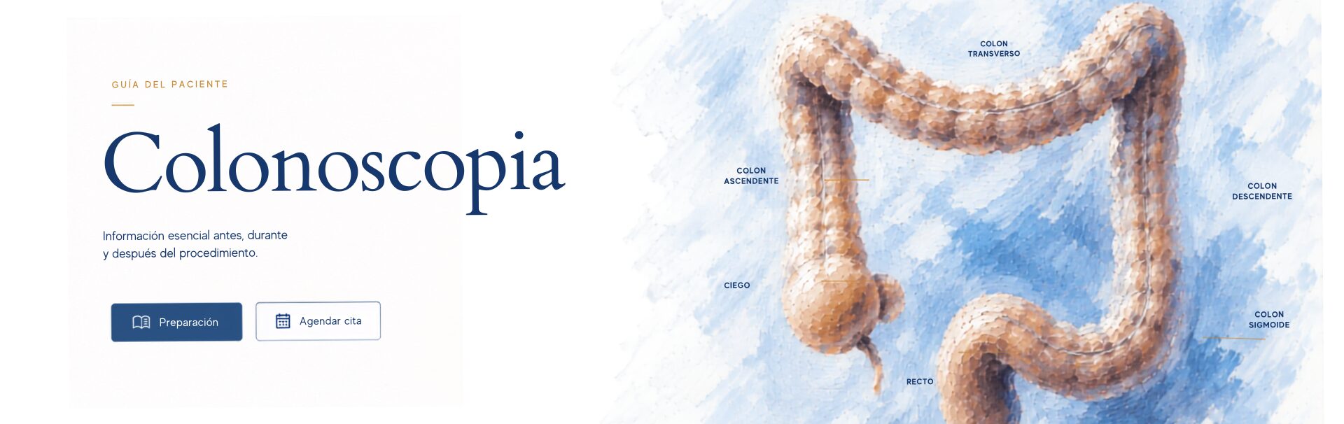 Colonoscopia — Guía del paciente